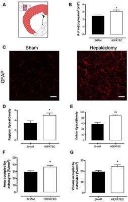 Acute Liver Failure Induces Glial Reactivity, Oxidative Stress and Impairs Brain Energy Metabolism in Rats